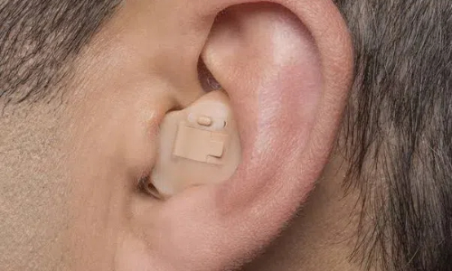 In-the-Ear (ITE) Hearing Aid 1.jpg